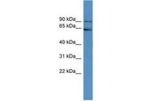 Image no. 1 for anti-Fragile X Mental Retardation 1 (FMR1) (AA 421-470) antibody (ABIN6746187) (FMR1 Antikörper  (AA 421-470))