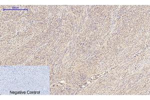 anti-Insulin Receptor Substrate 1 (IRS1) antibody