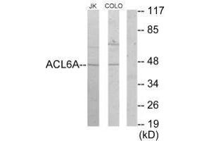 Western blot analysis of extracts from Jurkat cells and COLO205 cells, using ACL6A antibody. (BAF53A Antikörper)