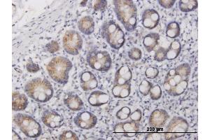 Immunoperoxidase of purified MaxPab antibody to IL17F on formalin-fixed paraffin-embedded human small Intestine. (IL17F Antikörper  (AA 1-163))