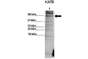 WB Suggested Anti-KAT5 Antibody  Positive Control: Lane 1: 50ug human RKO lysate  Primary Antibody Dilution :  1:500  Secondary Antibody : Goat anti-rabbit-Alexa Fluor 680  Secondry Antibody Dilution :  1:5000  Submitted by: Dr.