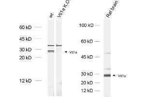 dilution: 1 : 1000, sample: brain homogenate from wildtype and Vti1a K. (VTI1A Antikörper)