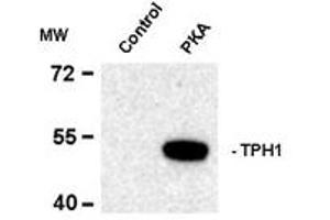 Image no. 2 for anti-Tryptophan Hydroxylase 1 (TPH1) (pSer58) antibody (ABIN227714) (Tryptophan Hydroxylase 1 Antikörper  (pSer58))