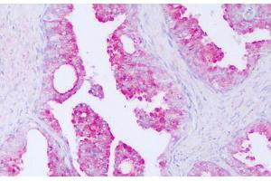 Image no. 1 for anti-Cysteine-Rich Secretory Protein 3 (CRISP3) (AA 69-118) antibody (ABIN6749801) (CRISP3 Antikörper  (AA 69-118))