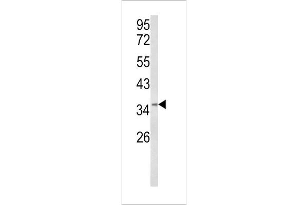 BRISC and BRCA1 A Complex Member 1 (BABAM1) (AA 116-143) Antikörper