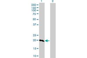 Western Blot analysis of SFTPC expression in transfected 293T cell line by SFTPC MaxPab rabbit polyclonal antibody. (Surfactant Protein C Antikörper  (AA 1-197))