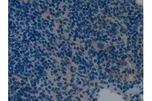 Immunohistochemistry (IHC) image for anti-Natriuretic Peptides B (NPPB) (AA 27-121) antibody (ABIN7445456)