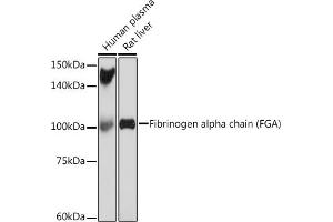 Western blot analysis of extracts of various cell lines, using Fibrinogen alpha chain (FGA) (FGA) Rabbit mAb (ABIN7267177) at 1:1000 dilution. (FGA Antikörper)