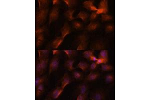 Immunofluorescence analysis of C6 cells using BRC antibody (1034) at dilution of 1:100. (BRCA1 Antikörper  (AA 400-699))