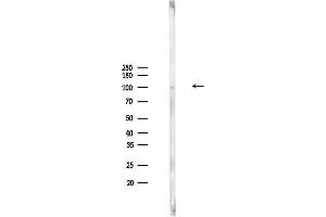 Western blot analysis of lysates from PC12 cells, using ATP6V0 Antibody at 1/1000 dilution.