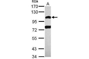 POM121 抗体  (N-Term)
