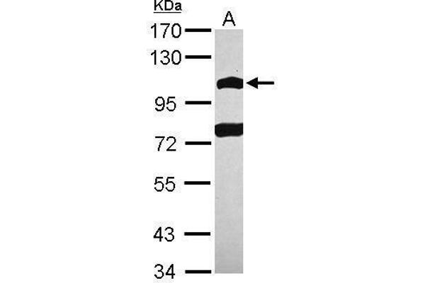 POM121 Antikörper  (N-Term)