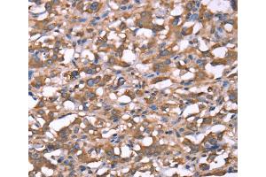 Immunohistochemistry (IHC) image for anti-Spastin (SPAST) antibody (ABIN2433051) (Spastin Antikörper)