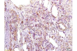 Immunohistochemistry (IHC) image for anti-Insulin-Like Growth Factor Binding Protein 2, 36kDa (IGFBP2) (AA 101-200) antibody (ABIN737781)