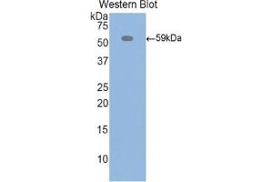 Detection of Recombinant ITIH4, Rat using Polyclonal Antibody to Inter Alpha-Globulin Inhibitor H4 (ITIH4) (ITIH4 Antikörper  (AA 478-722))
