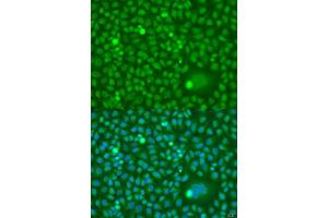 Immunofluorescence analysis of U2OS cells using CDK10 antibody. (CDK10 Antikörper  (AA 1-283))