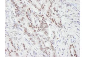 Immunohistochemistry (IHC) image for anti-Metastasis Associated 1 (MTA1) (AA 400-450) antibody (ABIN7448676)