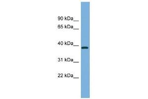 FBP2 antibody used at 1 ug/ml to detect target protein. (FBP2 Antikörper  (Middle Region))