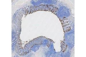 IHC analysis of Cytokeratin 8/KRT8 using anti-Cytokeratin 8/KRT8 antibody (ABIN5518853). (KRT8 Antikörper  (AA 107-325))