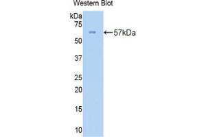 Western blot analysis of the recombinant protein. (COL3A1 Antikörper  (AA 1059-1466))