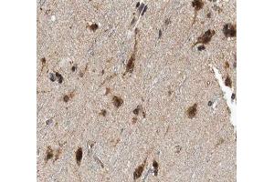 ABIN6266901 at 1/100 staining human brain tissue sections by IHC-P.
