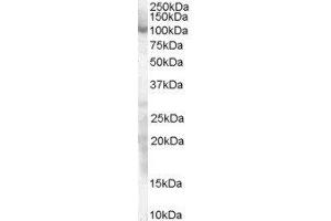 Western Blotting (WB) image for Sp1 Transcription Factor (SP1) peptide (ABIN369922)