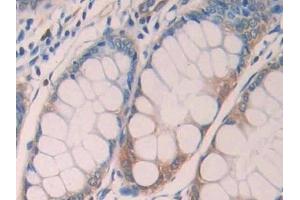 Immunohistochemistry (IHC) image for anti-Lysyl Oxidase-Like 4 (LOXL4) (AA 399-552) antibody (ABIN7437674)