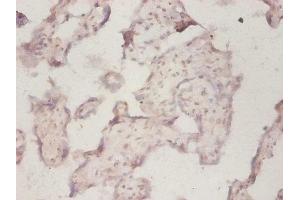 Immunohistochemistry of paraffin-embedded human placenta tissue using ABIN7142723 at dilution of 1:50 (RPLP1 Antikörper  (AA 2-114))