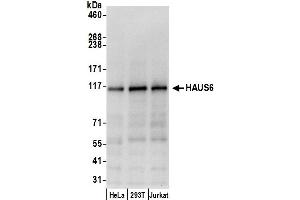 anti-HAUS Augmin-Like Complex, Subunit 6 (HAUS6) (AA 475-525) antibody