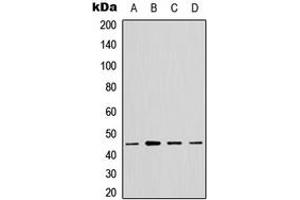 Western blot analysis of GTPBP5 expression in A549 (A), HeLa (B), NS-1 (C), PC12 (D) whole cell lysates. (GTPBP5 Antikörper  (Center))