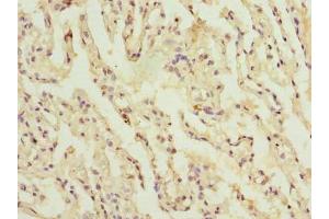 Immunohistochemistry of paraffin-embedded human lung tissue using ABIN7148104 at dilution of 1:100 (C1orf114 Antikörper  (AA 91-280))