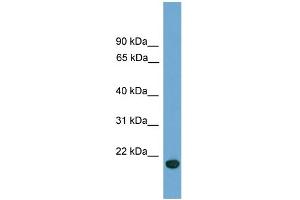 WB Suggested Anti-C9orf40 Antibody Titration: 0. (C9orf40 Antikörper  (Middle Region))