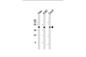 All lanes : Anti-PLIN3 Antibody at 1:2000 dilution Lane 1: Hela whole cell lysate Lane 2: K562 whole cell lysate Lane 3: Daudi whole cell lysate Lysates/proteins at 20 μg per lane. (PLIN3 Antikörper  (AA 1-434))