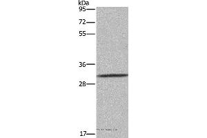 Western blot analysis of 231 cell, using ASGR1 Polyclonal Antibody at dilution of 1:300 (Asialoglycoprotein Receptor 1 Antikörper)