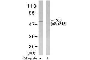 Image no. 1 for anti-Tumor Protein P53 (TP53) (pSer315) antibody (ABIN196788) (p53 Antikörper  (pSer315))