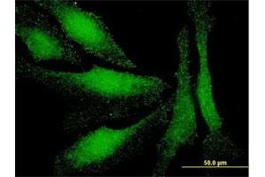 Immunofluorescence of monoclonal antibody to LMO3 on HeLa cell. (LMO3 Antikörper  (AA 91-146))