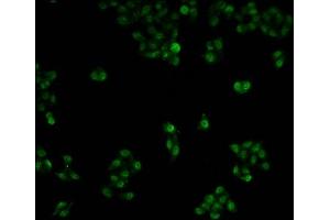 Immunofluorescence staining of Hela cells with ABIN7150422 at 1:100, counter-stained with DAPI. (POLR2A/RPB1 Antikörper  (AA 76-298))