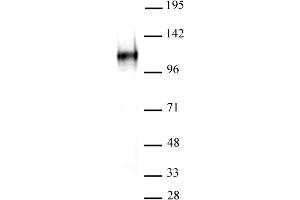 BCL11A antibody (mAb) tested by Western blot. (BCL11A Antikörper  (AA 637-835))
