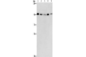 Western Blotting (WB) image for anti-Minichromosome Maintenance Complex Component 5 (MCM5) antibody (ABIN2421835) (MCM5 Antikörper)