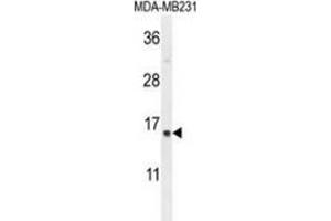Western blot analysis in MDA-MB231 cell line lysates (35ug/lane) using SPRR2A Antibody (C-term).