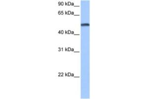 Western Blotting (WB) image for anti-Cytochrome P450, Family 1, Subfamily B, Polypeptide 1 (CYP1B1) antibody (ABIN2463468) (CYP1B1 Antikörper)