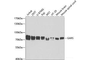 Western blot analysis of extracts of various cell lines using GARS Polyclonal Antibody at dilution of 1:5000. (GARS Antikörper)