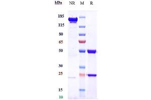 Anti-IGF1R / CD221 Reference Antibody (teprotumumab) on SDS-PAGE under reducing (R) condition.