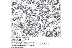 Human Lung (ZNF385A Antikörper  (N-Term))