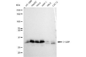 Western blotting analysis using C1QBP antibody (ABIN7798136). (Rekombinanter C1QBP Antikörper)