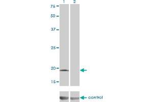DCMP Deaminase (DCTD) (AA 69-179) Antikörper