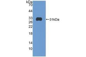Detection of Recombinant ITGb5, Human using Polyclonal Antibody to Integrin Beta 5 (ITGb5) (Integrin beta 5 Antikörper  (AA 137-378))