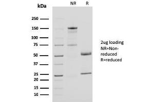 SDS-PAGE Analysis Purified CD40L Mouse Monoclonal Antibody (CD40LG/2761). (CD40 Ligand Antikörper  (AA 108-261))