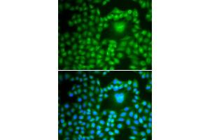 Immunofluorescence analysis of U2OS cells using PP1 beta antibody . (PPP1CB Antikörper  (AA 1-327))