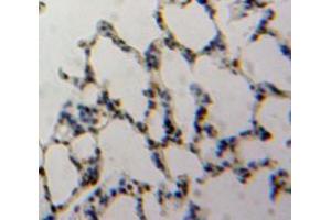 Used in DAB staining on fromalin fixed paraffin-embedded Lung tissue (TBX4 Antikörper  (AA 284-545))
